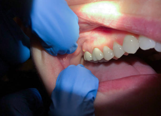 Best Broken Tooth Emergency  in Granbury, TX